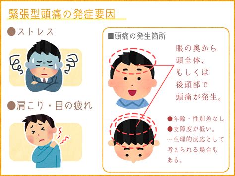 頭痛 原因|頭痛・顔面痛の種類と原因｜受診科と自分でできる対処法も紹介 